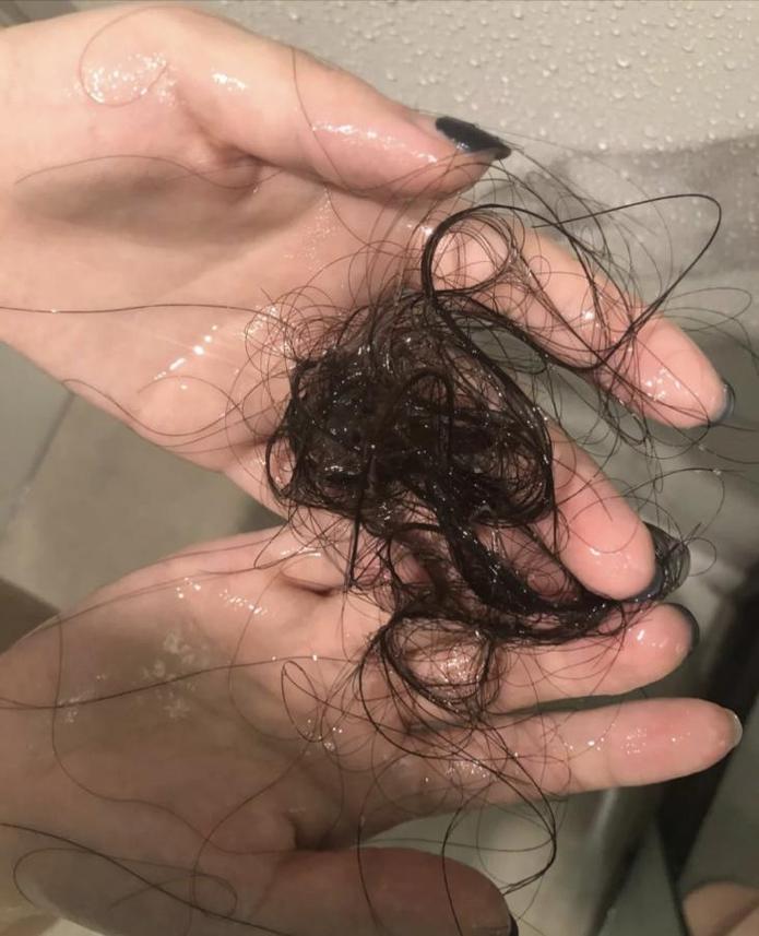 自然脱落的头发还会长吗_脱发增多？看这里！