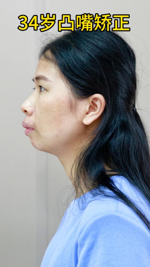 凸嘴适合什么发型女_中分侧分短发，蓬松刘海马尾，轻松遮嘴凸