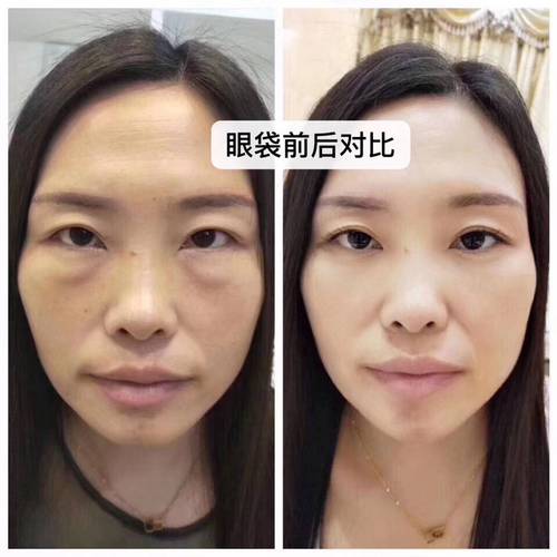 大眼袋女生化妆全过程_眼袋黑眼圈遮瑕攻略