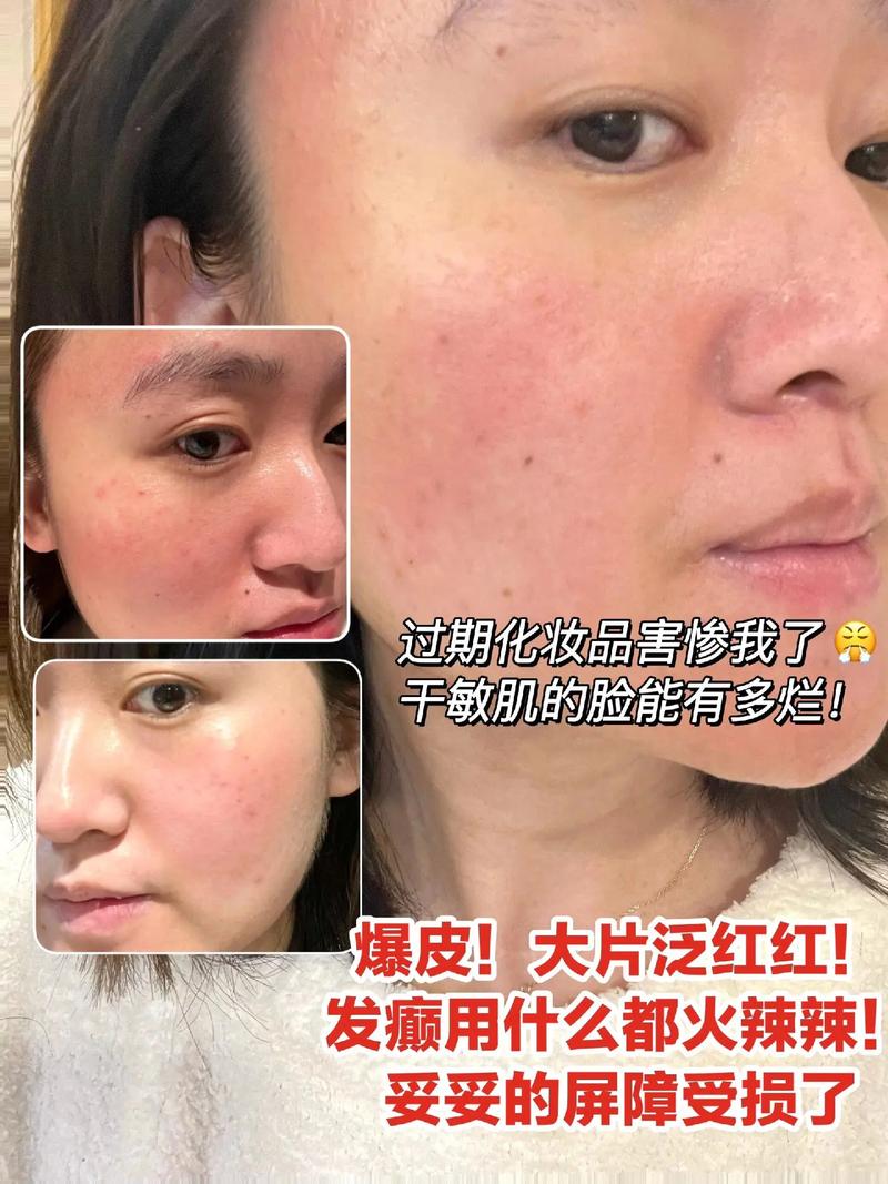 长期使用化妆品危害_化妆品伤皮肤？选对用对保健康！