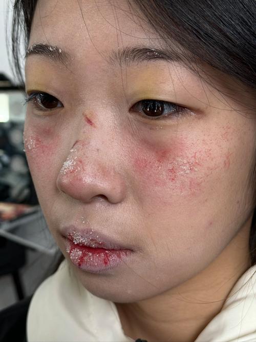 长期不化妆皮肤会变差吗_成分双面影响护肤，健康生活更关键