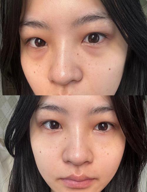 黑眼圈用遮瑕还是粉底_粉底遮黑眼圈？用对颜色就对了！