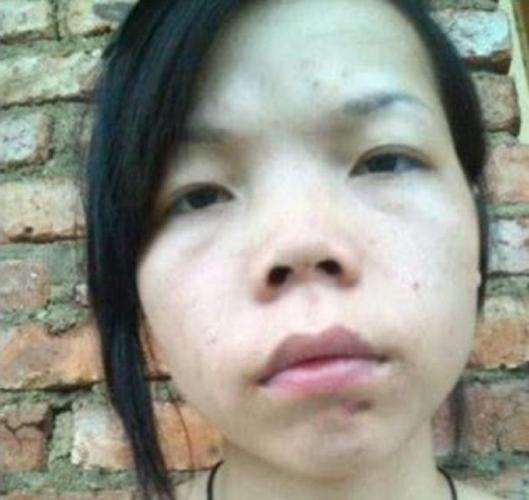 不化妆照片鼻子看着不挺_不化妆鼻子塌？医美或真管用！