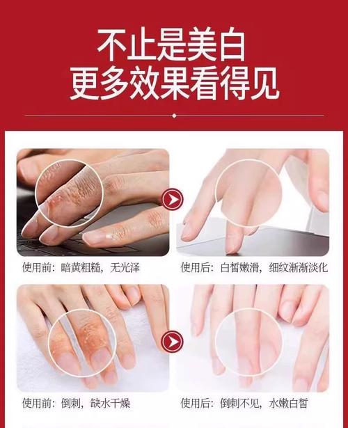 关节黑怎么用化妆品遮盖_关节黑？唇膏美白乳液遮盖，防晒保湿不能少