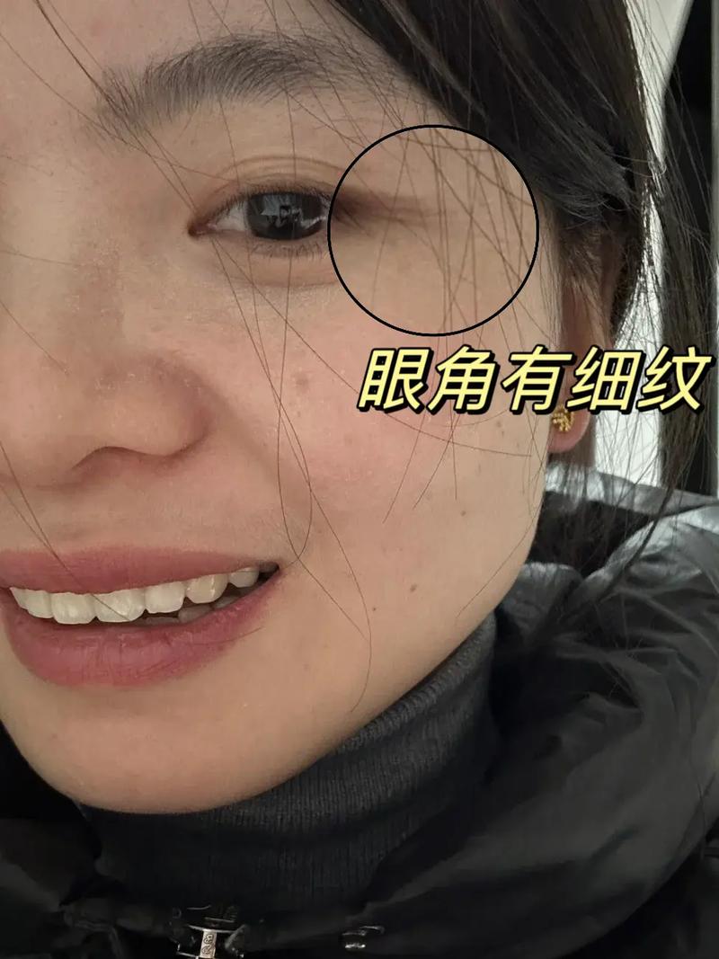 鱼尾纹怎么化妆遮盖_遮瑕加保养，预防是关键