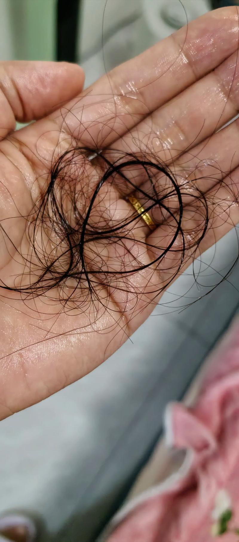 染头发掉发快还是烫头发掉发快_烫染伤毛囊致脱发?选对护理能缓解 染头发掉发快还是烫头发掉发快_烫染伤毛囊致脱发?选对护理能缓解