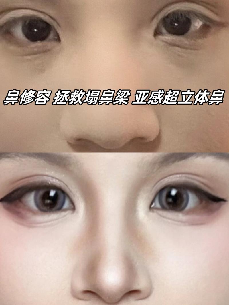 不用做手术不化妆让鼻子变挺_按摩热敷化妆鼻夹，不手术让鼻子变挺