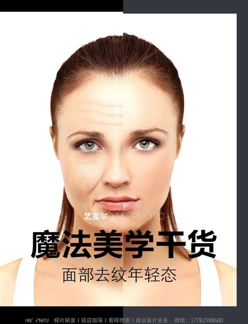 面部年轻化的最好方法_光子射频填充线，果酸焕肤全面改善