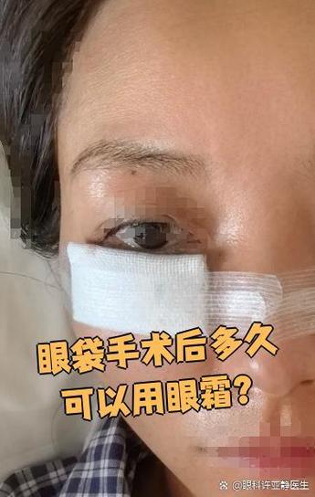 内切眼袋多久可以化妆_内切眼袋3-5天可化妆，注意轻柔温和，恢复因人而异