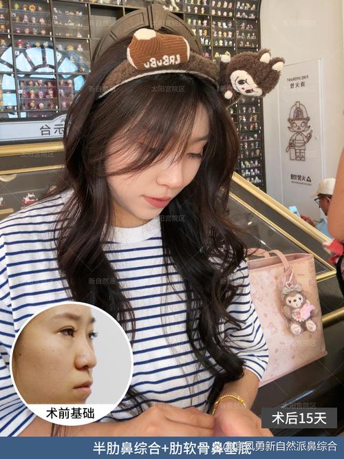 做完鼻子20天可以化妆吗_隆鼻20天后谨慎化妆，避开切口轻描淡妆防感染