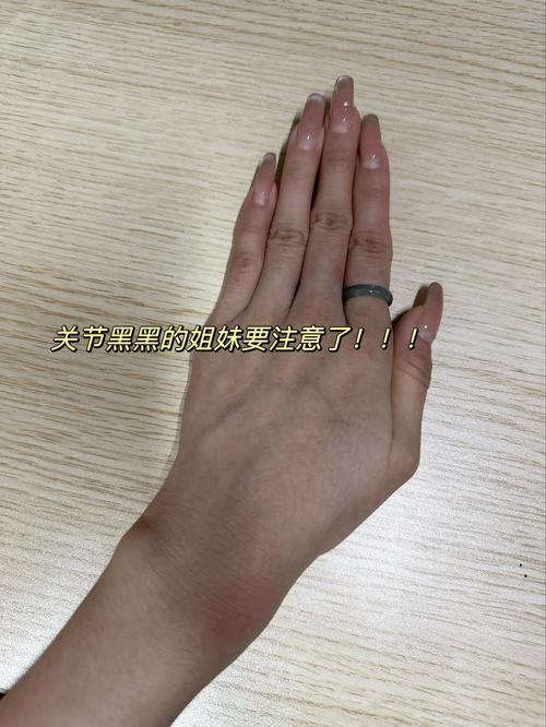 去关节黑最有效的方法_关节黑斑多因污垢堆积导致，需温和清洁并轻柔去角质