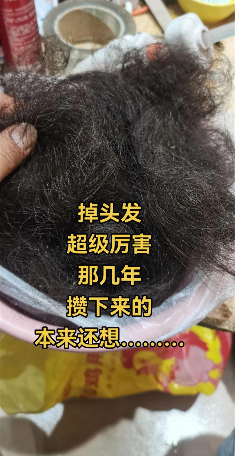 捋头发总掉一两根正常吗_掉发增多？别慌，正常现象！