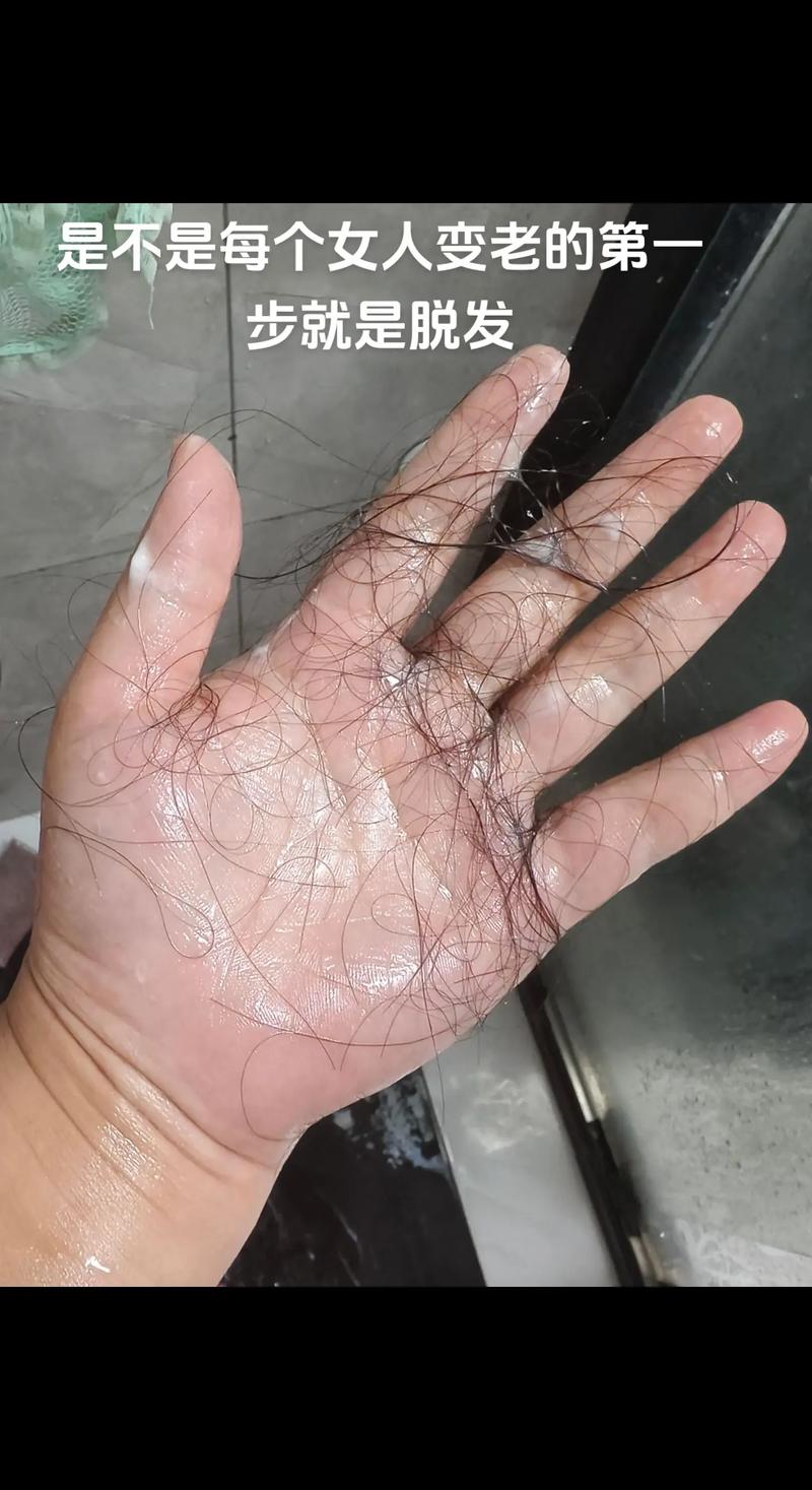 青少年掉头发正常吗_青少年掉发多？别慌，日常护理来帮忙！