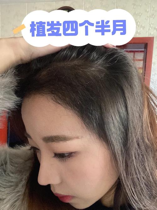 四个月头发能留多长_头发每月长1-2厘米?这样促生长! 四个月头发能留多长_头发每月长1-2厘米?这样促生长!