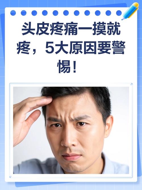 摸下头发头皮都会疼_摸头发头皮疼？快查查原因别大意！