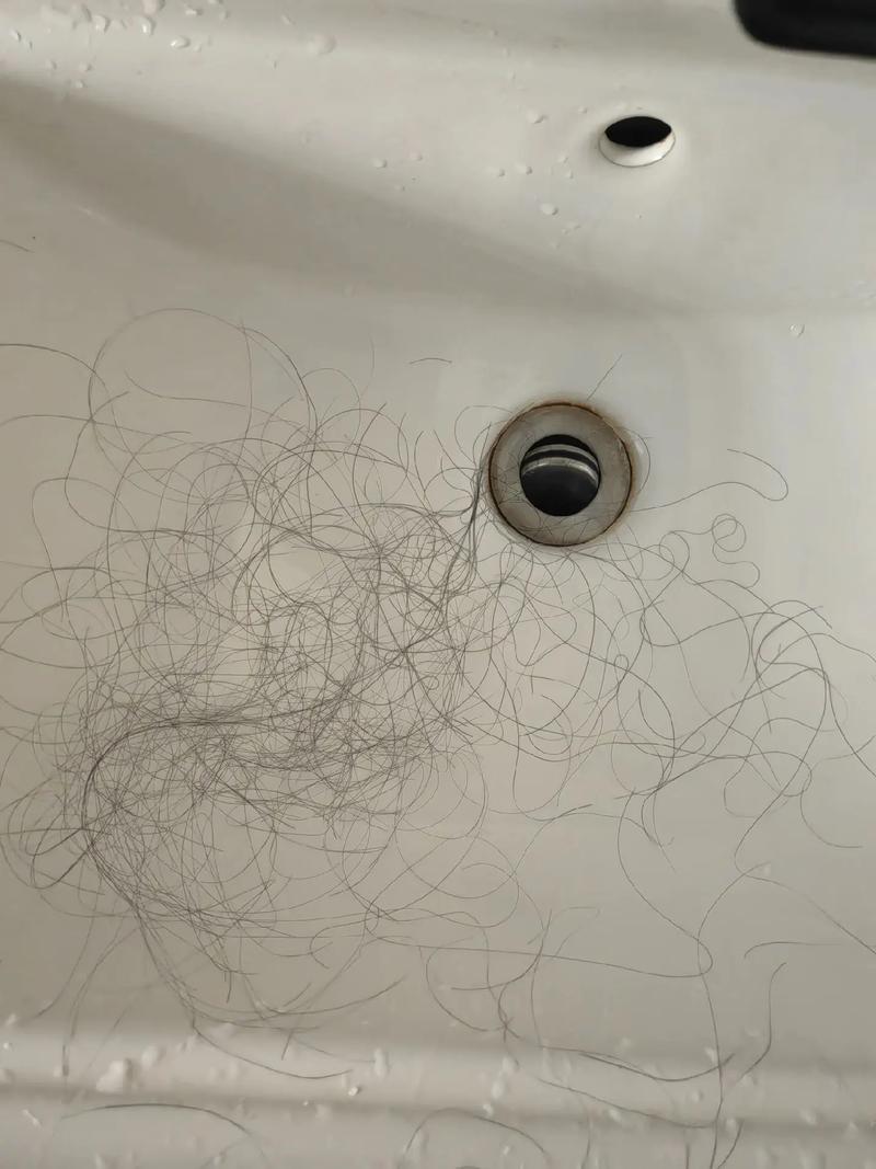 熬夜掉头发还能长回来吗_熬夜掉发休止期脱发怎么办？