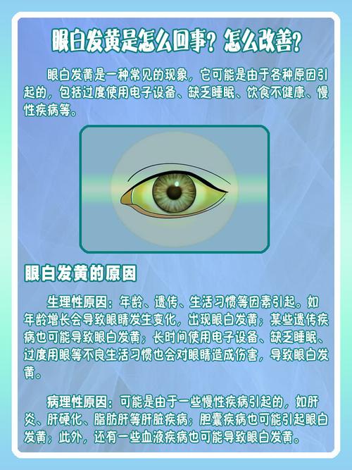 眼白发黄是什么原因_眼白发黄？多注意生活习惯和体检！