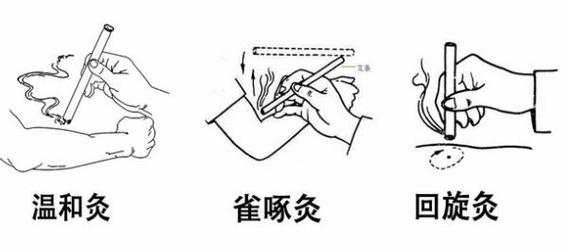 炙的方法有几种_中医古法，治病保健好选择