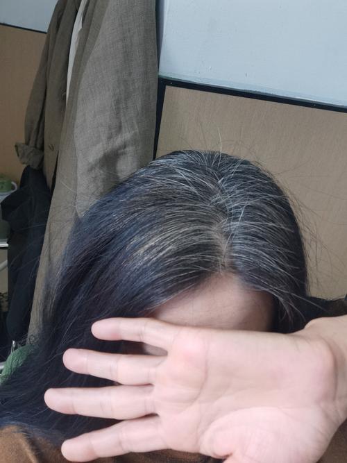 前刘海一绺头发变白_白发多？查营养防压力！