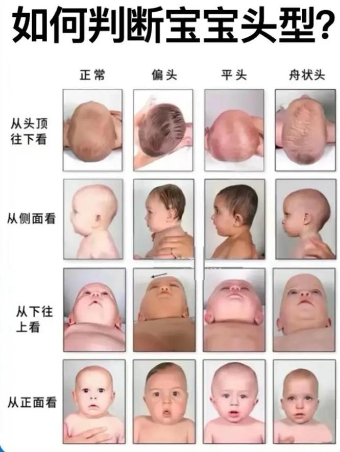 舟状头最忌三种头发型_发型妆容配饰巧用,视觉更平衡 舟状头最忌三种头发型_发型妆容配饰巧用,视觉更平衡