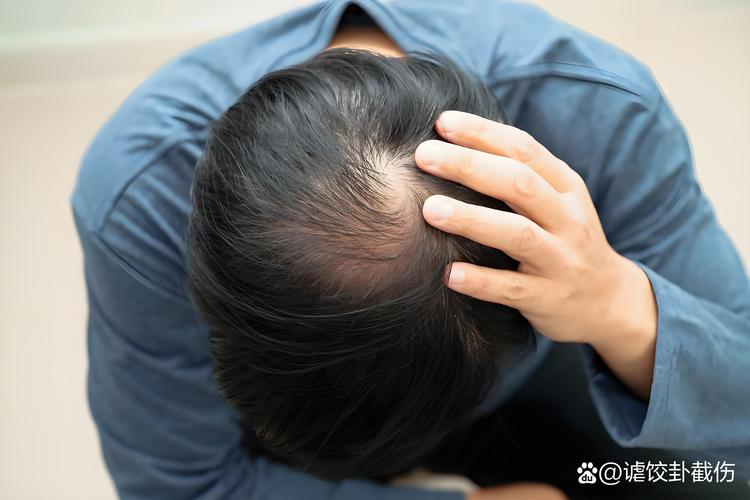 一摸头顶的头发感觉头皮痛_头皮疼？多原因导致，别大意！