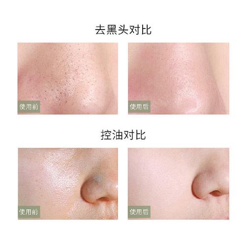 查什么化妆品让脸变白_多通路淡斑,敏感肌也适用 查什么化妆品让脸变白_多通路淡斑,敏感肌也适用