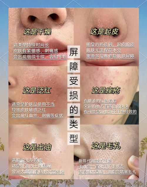 把化妆品打到皮肤里怎么办_化妆品灼伤别慌,清水冲洗冷敷,注意过敏! 把化妆品打到皮肤里怎么办_化妆品灼伤别慌,清水冲洗冷敷,注意过敏!