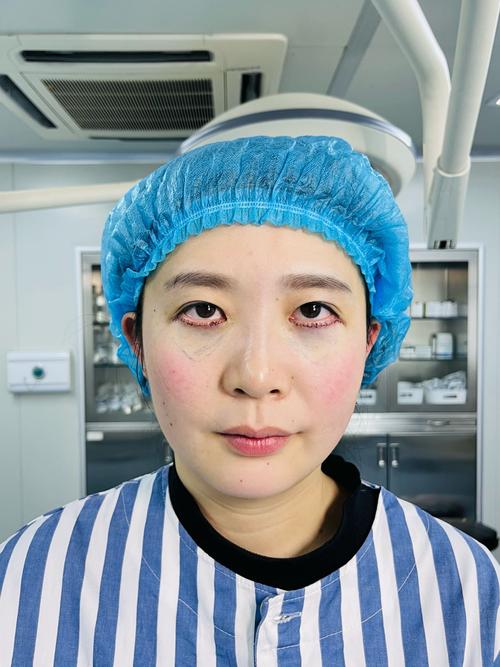 外切眼袋20天可以化妆吗_外切眼袋术后20天忌化妆，待伤口愈合再美丽