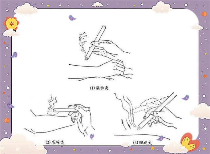 艾条灸详细操作步骤_温和雀啄回旋隔物瘢痕灸 艾条灸详细操作步骤_温和雀啄回旋隔物瘢痕灸