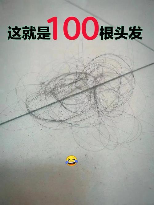 每天掉头发超过30根_每天掉30根头发正常吗？