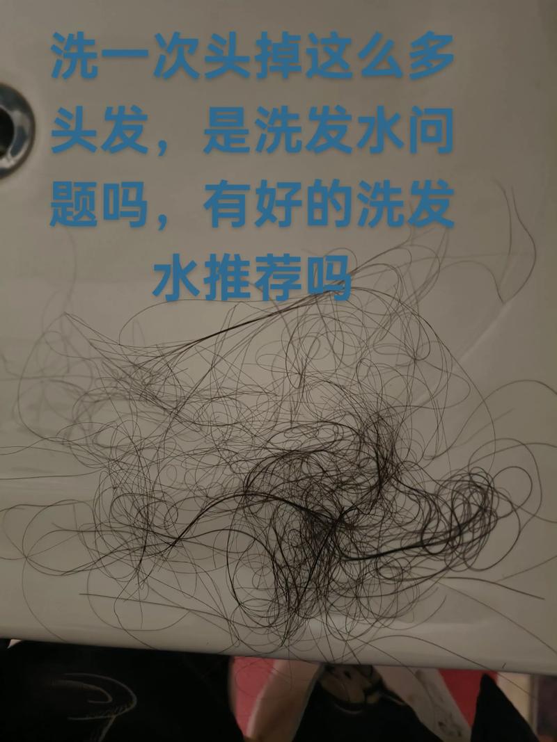 每天洗头都掉头发正常吗_洗头掉发多？注意生活习惯调整！