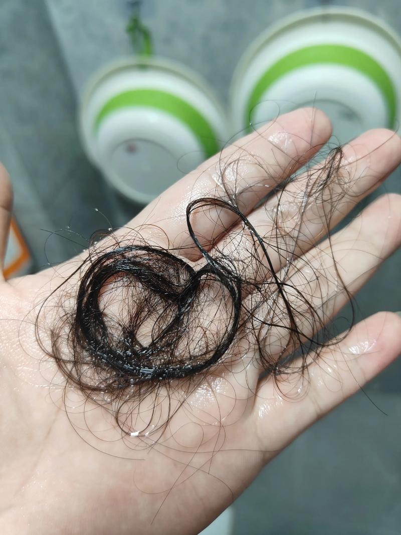 一抓头发就掉下来几根正常吗_脱发50-100根正常？抓掉5根以上要当心！