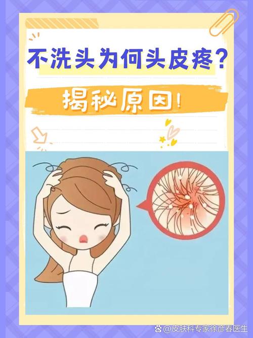 很久没洗头发头皮很痛_头痒痛？勤洗头，选温和洗发水！