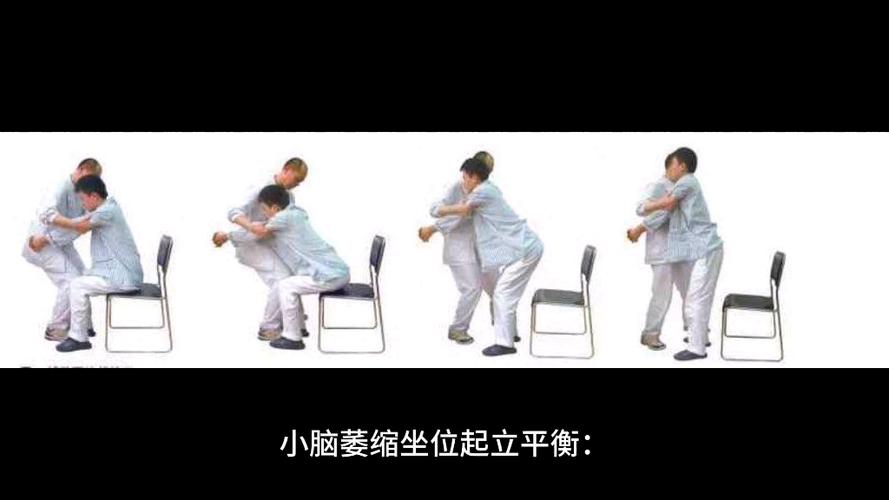 小脑萎缩锻炼方法_平衡协调步态语言认知训练 小脑萎缩锻炼方法_平衡协调步态语言认知训练