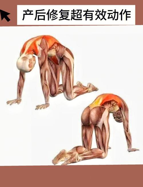 腹直肌的锻炼方式_修复松弛腹直肌，练出紧致马甲线