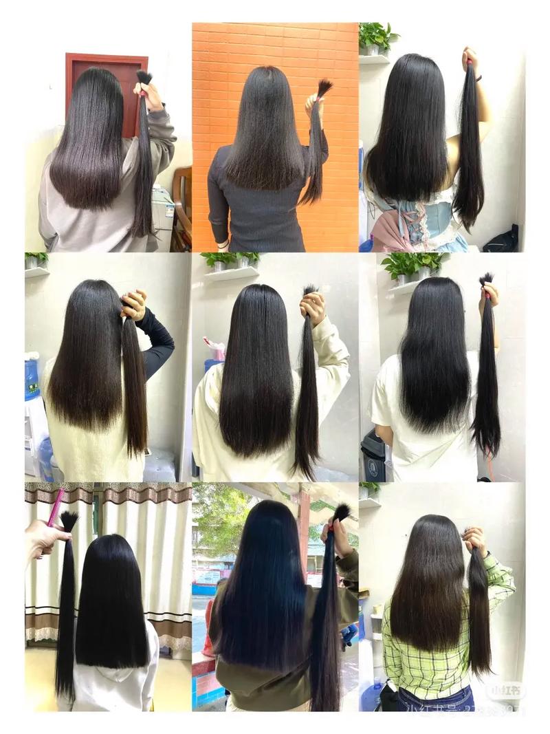 五个月头发长度对比照_头顶新发长出，坚持使用是关键