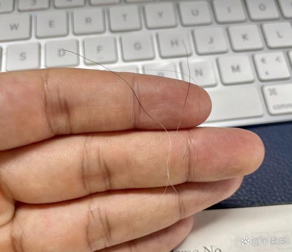 逆方向拨动头发发根痛怎么办_发根疼痛怎么办?试试这些方法! 逆方向拨动头发发根痛怎么办_发根疼痛怎么办?试试这些方法!