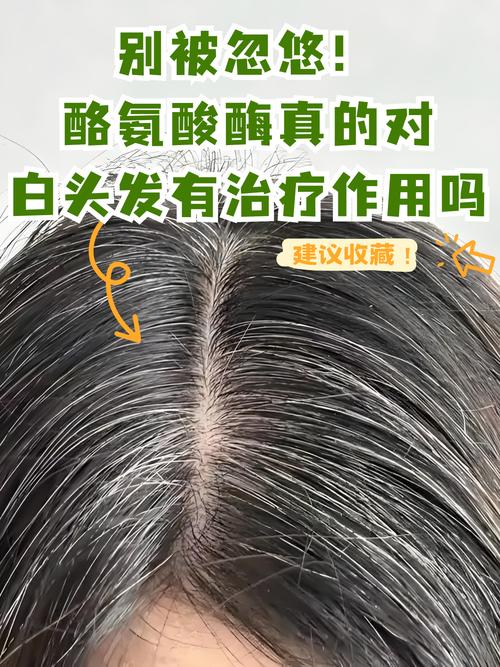 护发素对白头发有害吗_白发增多不用愁，护发素效果有限，健康饮食减压是关键