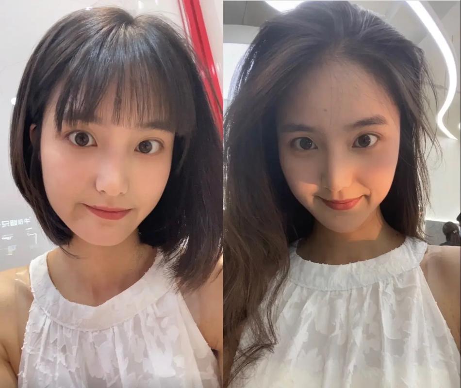 五个月头发长度对比照_头顶新发长出，坚持使用是关键