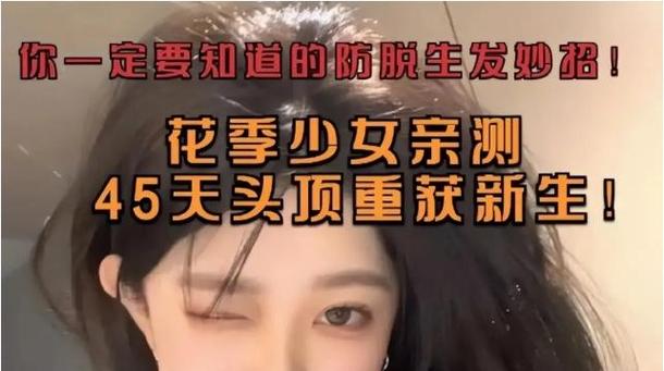 44岁头发掉的厉害，怎么回事_40岁脱发？激素压力惹的祸，营养生活习惯是关键