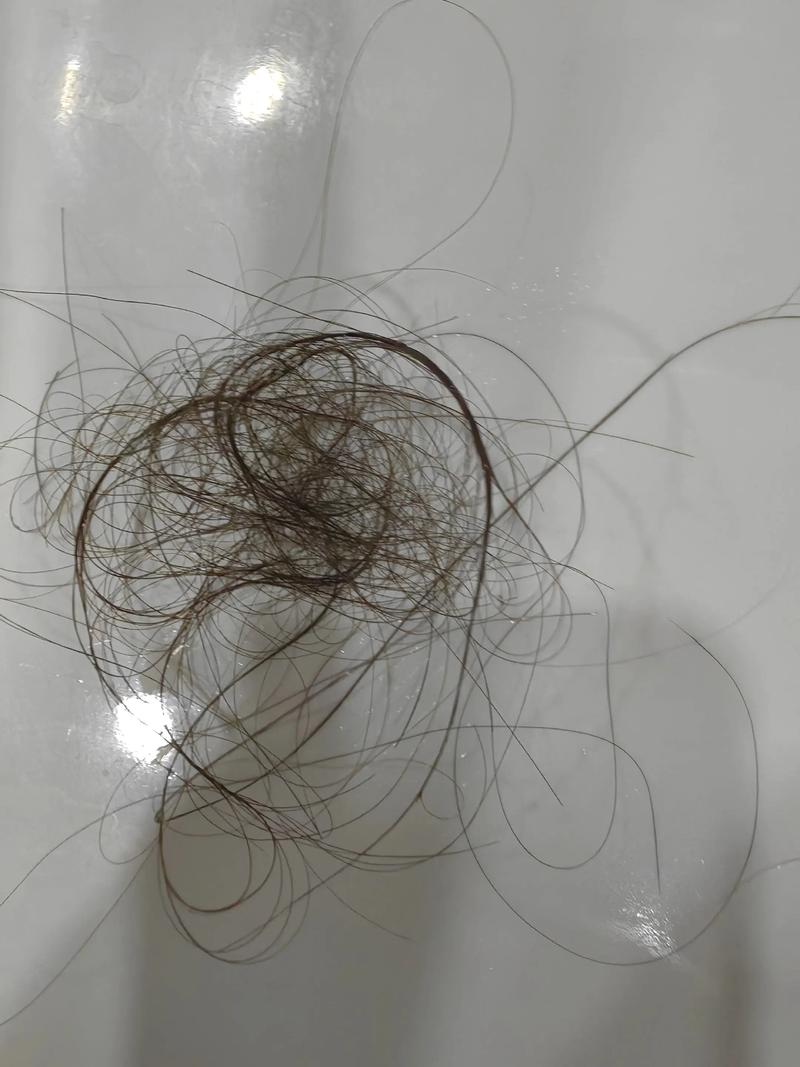 3天洗一次头掉100根头发_每天掉发50-100根是正常的