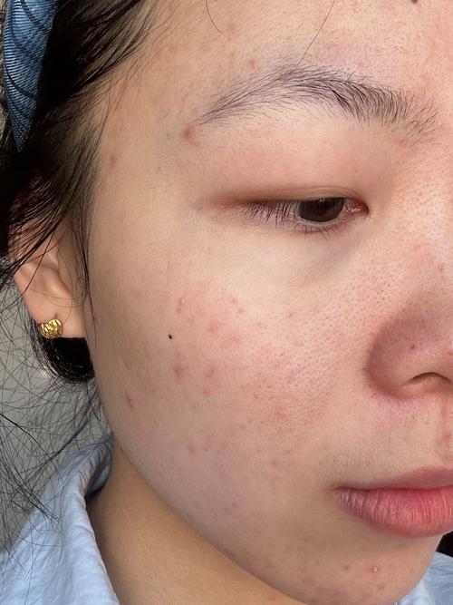 没开封的化妆品在高原会喷吗_高原化妆品易爆炸？挤空保鲜膜防喷！