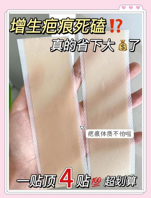 剖腹产疤痕贴正确使用方法_剖腹产疤痕贴的正确使用方法与注意事项