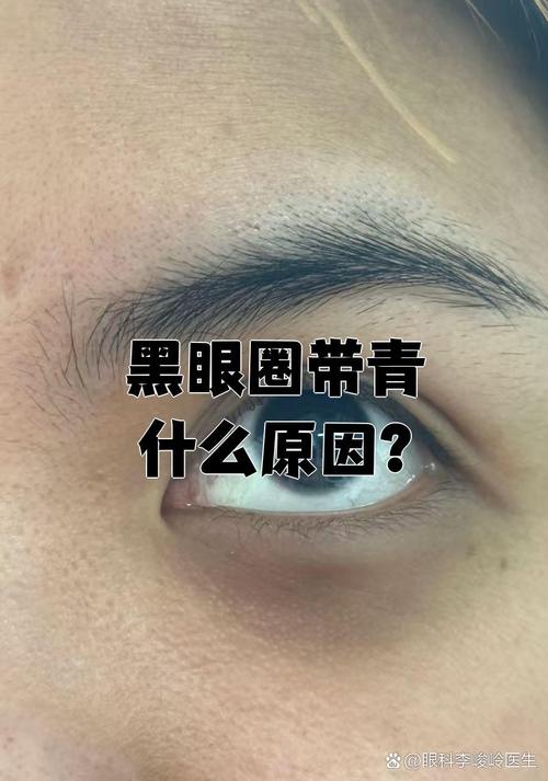 青褐色的黑眼圈遮瑕_绿色紫粉法，肤色提亮有光！