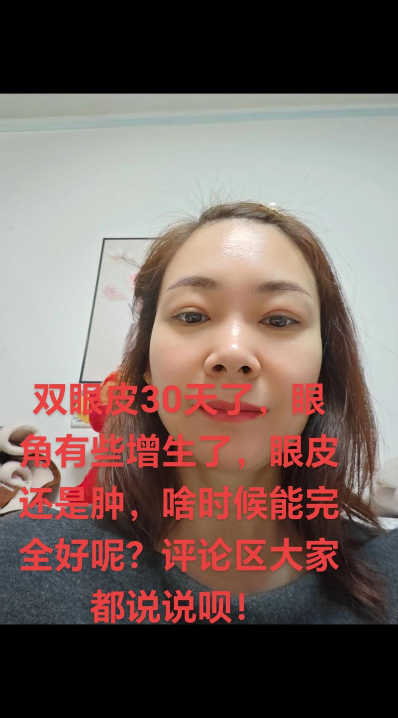 割双眼皮15天能化妆吗_双眼皮术后15天可淡妆，一个月后浓妆，注意护理防感染
