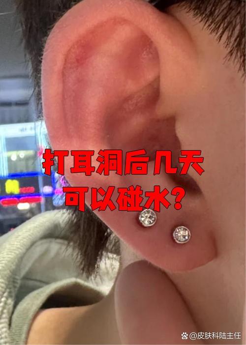 刚打完耳洞可以洗头发吗_3-7天洗头，注意防水消毒！