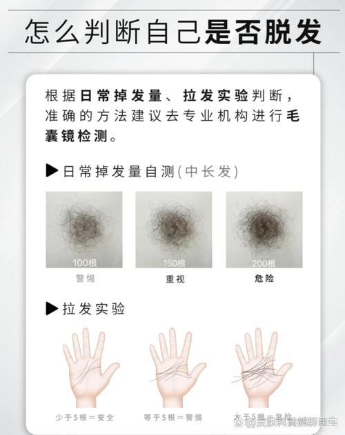 秃头长头发大概要多久_脱发能长回吗？看原因，分快慢！