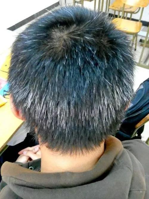 颈部长了一根白头发_脖白发多?注意营养和休息! 颈部长了一根白头发_脖白发多?注意营养和休息!