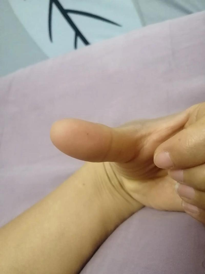 手上扎进头发小妙招_手指头发扎进去了？教你简单处理方法！