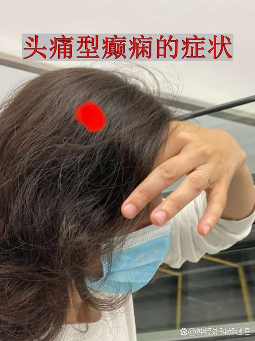 头左半边一摸头发就痛_左半边头皮痛是什么原因？